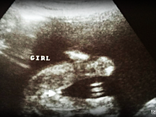 Ребел Уилсон похудела, чтобы заморозить яйцеклетки