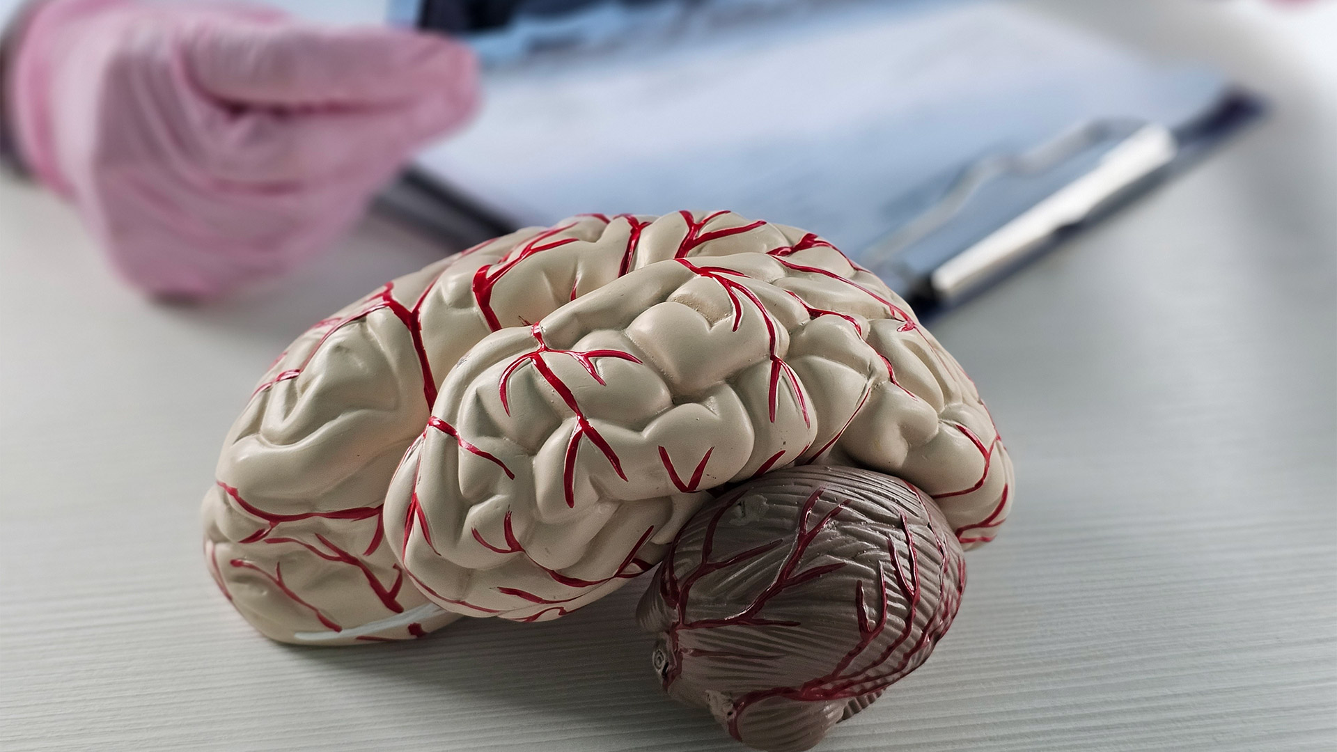 Редкий диагноз меняет речь на иноязычную – как страдает мозг