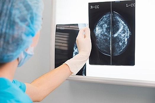 Заболеваемость раком молочной железы в Подмосковье неуклонно снижается