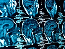 Загадочная неизлечимая болезнь поразила десятки молодых людей