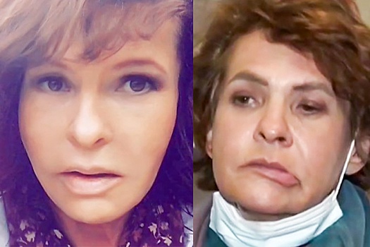 Следственный комитет предупредил об опасности пластических операций