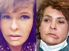 Следственный комитет предупредил об опасности пластических операций