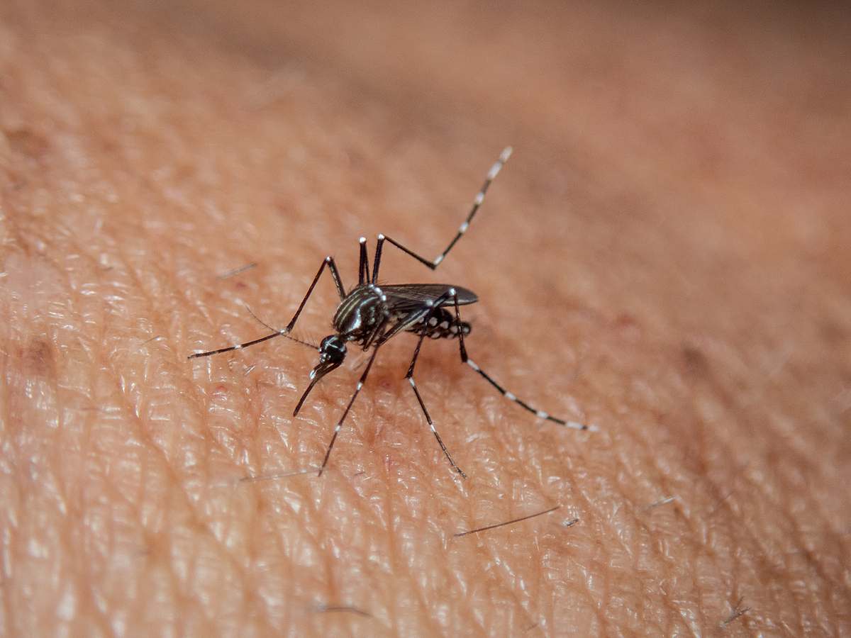 Как справиться с зудом после укусов комаров. Домашние способы