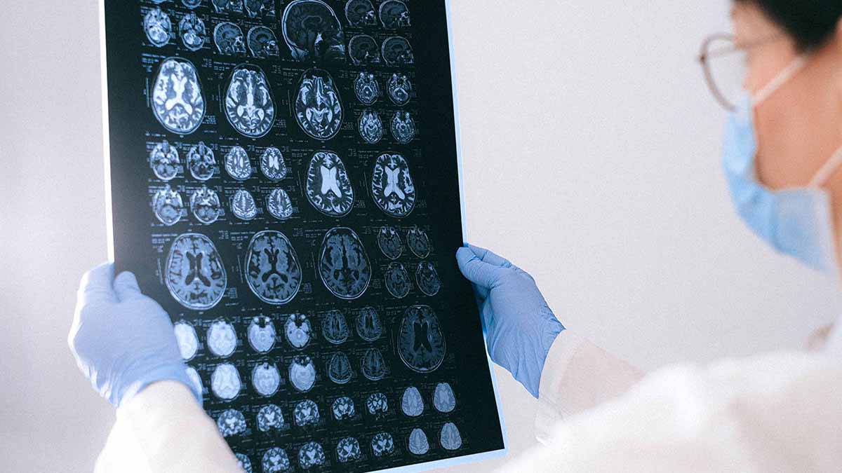 Он умеет думать: российские ученые вырастили в пробирке уникальный искусственный мозг