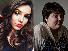 «Для всех я просто пропала»: жизнь юной красавицы превратилась в кошмар после страшной аварии