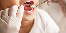Как уберечь детские зубы от кариеса