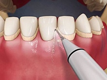 Бесплатную профгигиену полости рта будут проводить для коллег стоматологи ННГУ