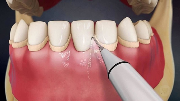 Бесплатную профгигиену полости рта будут проводить для коллег стоматологи ННГУ