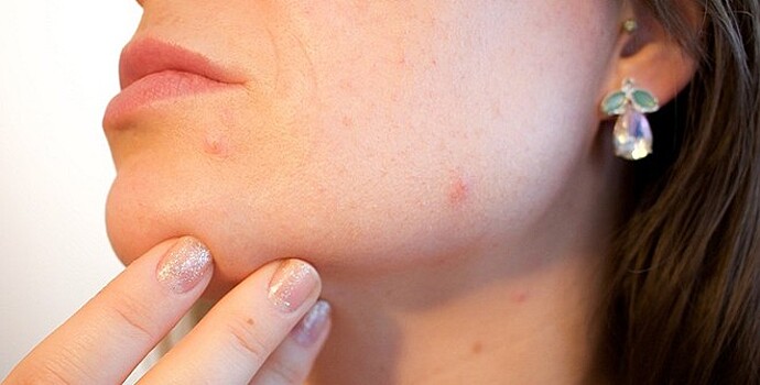 Ухудшение состояния кожи свидетельствует о серьёзном заболевании