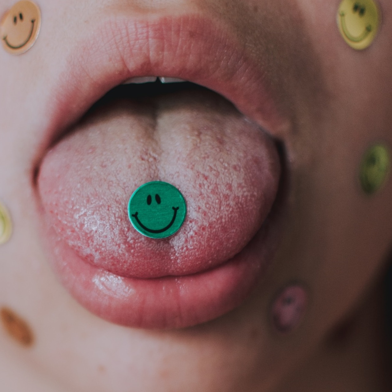 Кариес и его причины