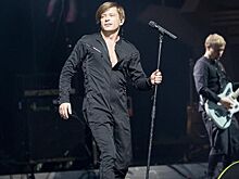 BAFTA-2018: самые провальные образы звезд