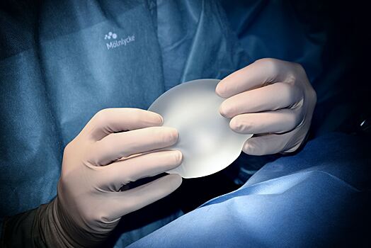 Пластический хирург назвал опасность большой силиконовой груди
