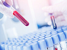 Местоблюстителя патриарха Грузии могли отравить