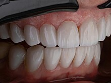 Куда едут россияне, чтобы вылечить зубы