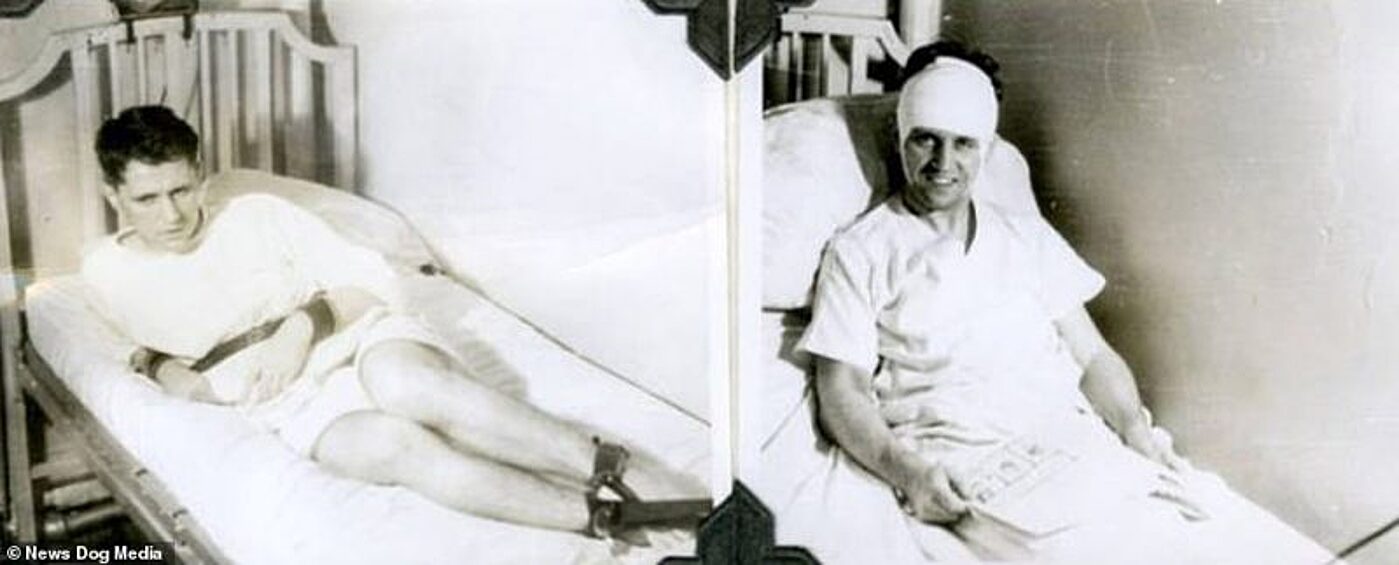 На этих фотографиях — пациенты Уолтера Фримана (Walter Freeman) из Вашингтона, который был одним из самых известных врачей, проводивших лоботомию. Он делал снимки «до» и «после», чтобы убедить людей в пользе страшного метода.