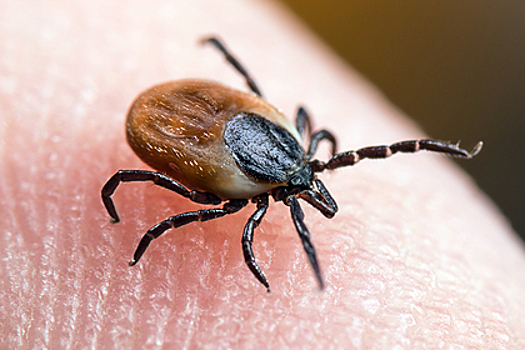 Россиянам рассказали о характерных симптомах переносимых клещами болезней