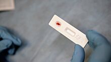 Главный внештатный инфекционист ДФО отозвалась о новом чудо-лекарстве от ВИЧ