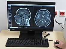 В Сибири создали программу для распознавания опухоли мозга на снимках МРТ