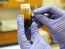 Петербургский депутат предлагает объявить ВИЧ-диссидентские организации экстремистскими