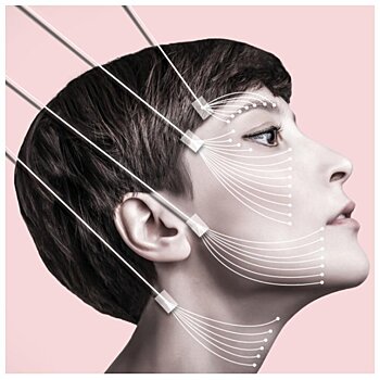 Стоит ли ставить нити в лицо? Изучаем все за и против