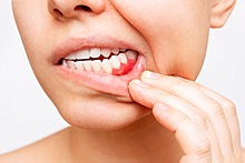 Стоматолог Ирина Антонова: По состоянию десен и зубов можно заподозрить общие заболевания человека