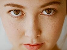 Как бороться с акне: советы косметолога