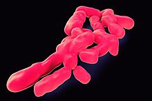 Сифилис впервые проявился в виде тонзиллита без сопутствующих симптомов