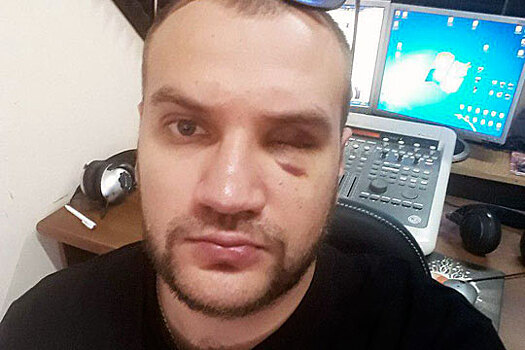 Диджей намерен взыскать с МВД 1 млн рублей за потерянный глаз