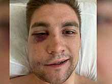 В Дублине избили украинского актера Грекова