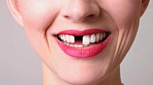 Выпавшие зубы расскажут, сколько осталось жить человеку