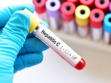 Фонд "Круг добра" одобрил 2 тысячи заявок на лечение детей с гепатитом С. Почему не надо откладывать лечение, объяснил академик РАН Юрий Лобзин