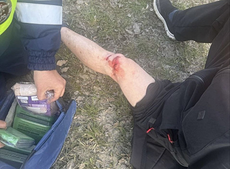 В Самаре самокатчик врезался в "Гранту" и повредил ногу