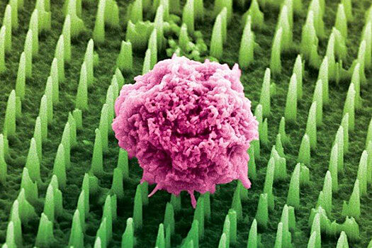 Найден способ заменить самый болезненный метод диагностики в медицине