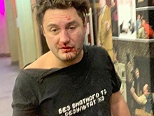 Посетитель МДМ обвинил охранников в побоях