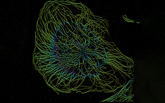 Ученые описали ветвление микротрубочек скелета клетки