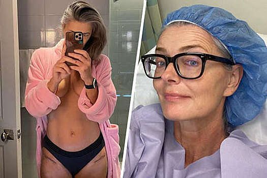 Модель Паулина Поризкова показала шрамы после операции на бедрах