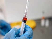 Эксперты фиксируют увеличение случаев кори в мире