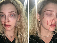 Девушка солиста HammAli & Navai жестко избила актрису в клубе 