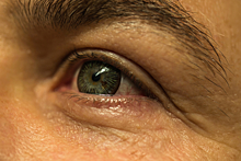 Ученые рассказали о пациентах с COVID-19, потерявших зрение