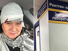 Депутат Хурала Бурятии разбила голову в центре Улан-Удэ