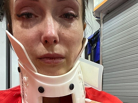 "Выбила четыре зуба, начала плакать": телеведущая РЕН ТВ пострадала в аварии