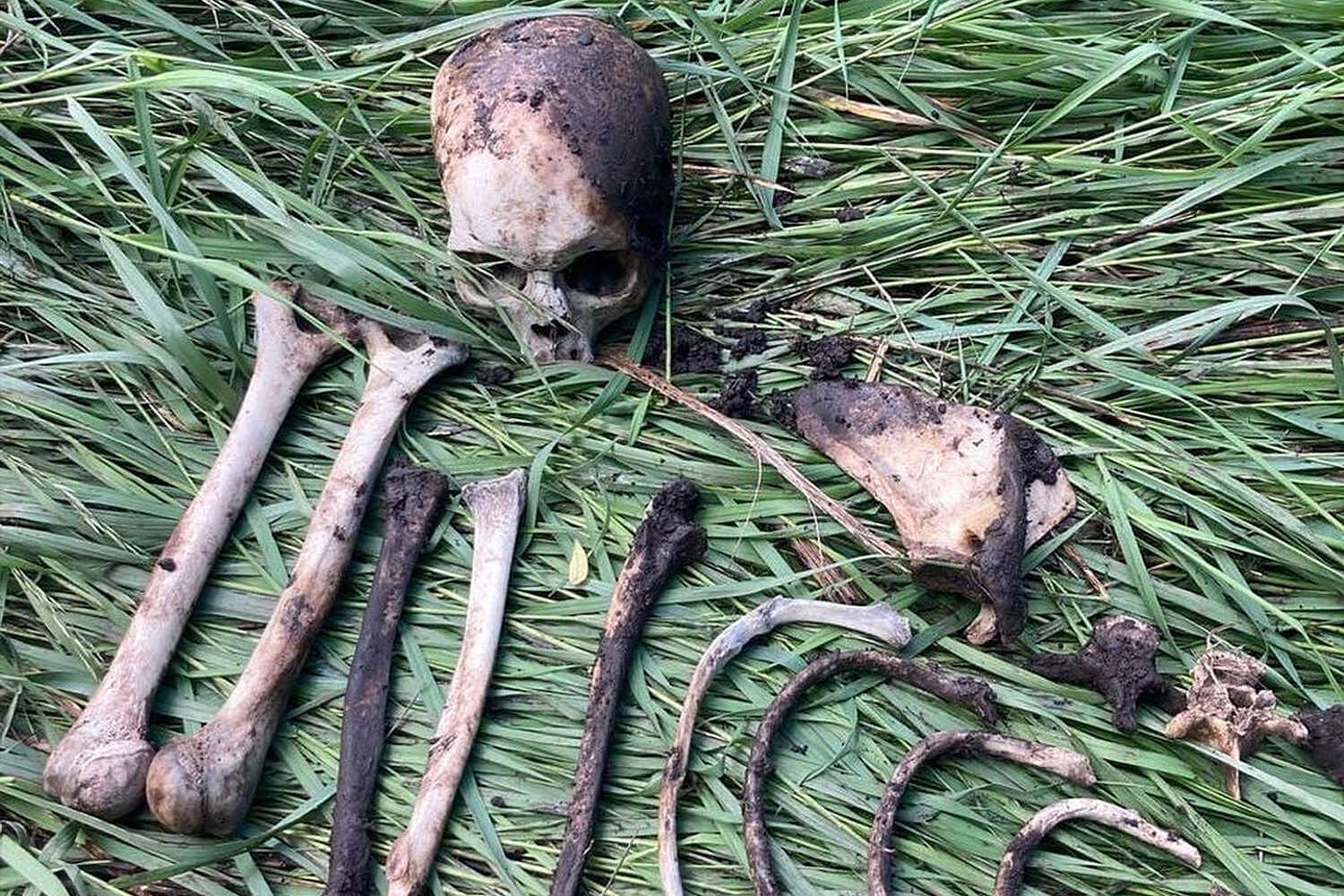 Человеческий скелет нашли в лесу Магаданской области