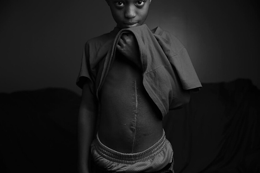 В номинации «Художественная фотография» премия досталась американцу И. Джейсону Уэмбсгенсу — за фотоисторию об американке, борющейся за жизнь своего 10-летнего сына, который был ранен во время стрельбы в Чикаго