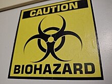 Американские биолаборатории окружают Россию со всех сторон: на Украине бушуют вспышки гепатита и кори