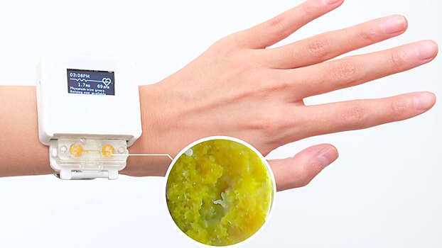 Ученые из США создали живые смарт-часы со слизевиком
