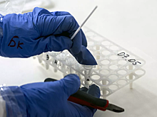 В больнице имени Спасокукоцкого рассказали о работе по борьбе с COVID-19