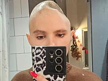 25-летняя блогер Ира Небога скончалась после многолетней борьбы с саркомой