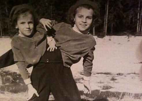 Даша и Маша Кривошляповы: какими были самые известные сиамские близнецы в СССР