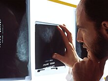 Ученые узнали, есть ли связь между плотностью груди и риском рака