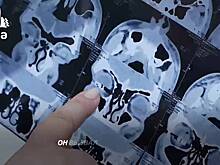 Российский подросток лишился глаза в тире